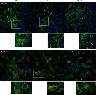 Possible Therapeutic Utility of anti-Cell Adhesion Molecule 1 Antibodies for Malignant Pleural Mesothelioma